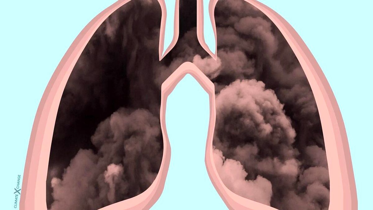 احتمال رسوب مواد سنگین آلودگی هوا و گرد و خاک در ریه ها جدی اشت