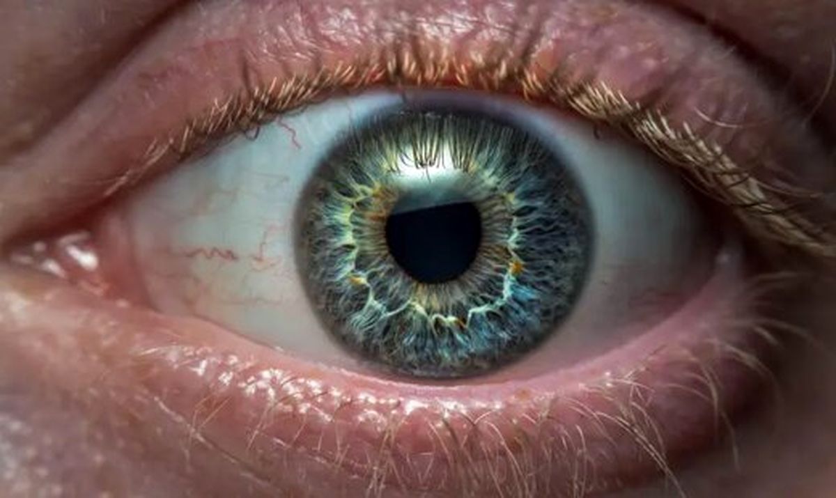 آیا چشم‌ها پنجره سلامت کلی بدن ما هستند؟
